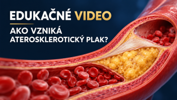 Edukační video o vzniku aterosklerotického plátu a úloze cholesterolu v tepnách.